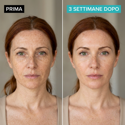 LUMINARA™ Siero al Collagene Levigante Antirughe